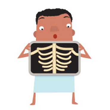 Xray cartoon